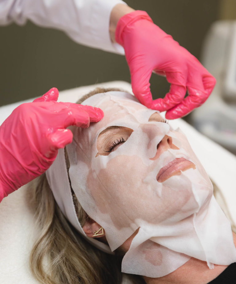 ChemicalPeel