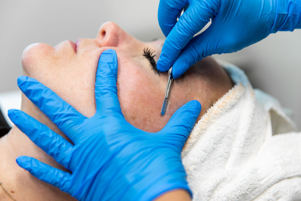 Dermaplaning