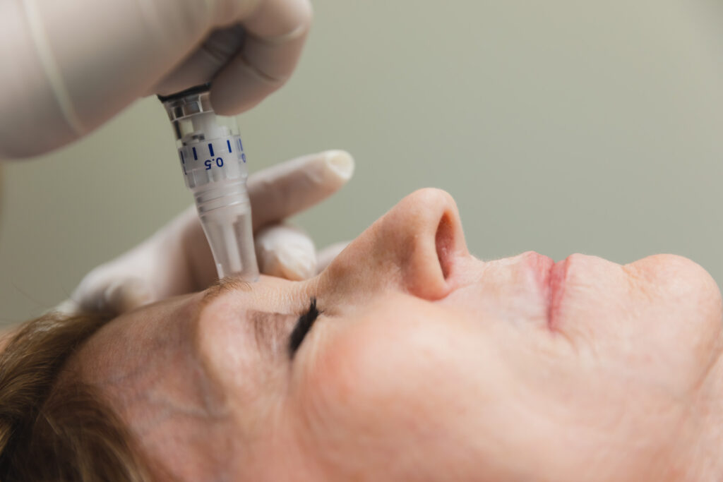 Microneedling