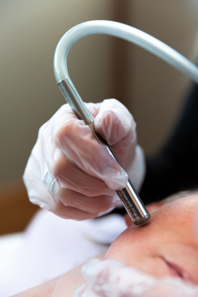 Premier-Skin-Clinic-Microdermabrasion